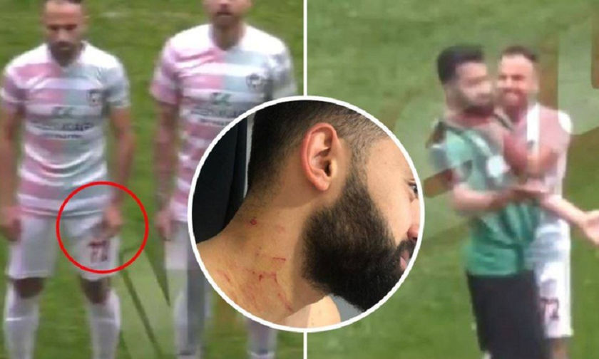 Τούρκος παίκτης χαράκωσε αντίπαλο με ξυραφάκι (Video)