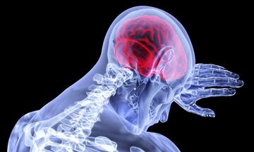 Mίνι εγκεφαλικό: Μπορεί να το έχεις πάθει - Με ποια συμπτώματα χτυπάει