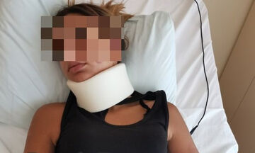 Λαμία: Τρεις 17χρονες ξυλοκόπησαν 13χρονη, η οποία νοσηλεύεται στο Γ. Ν. Λαμίας