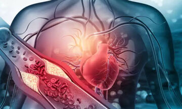 Η «καλή» χοληστερόλη δεν είναι πάντα καλή: Ποιος ο κίνδυνος για την καρδιά!