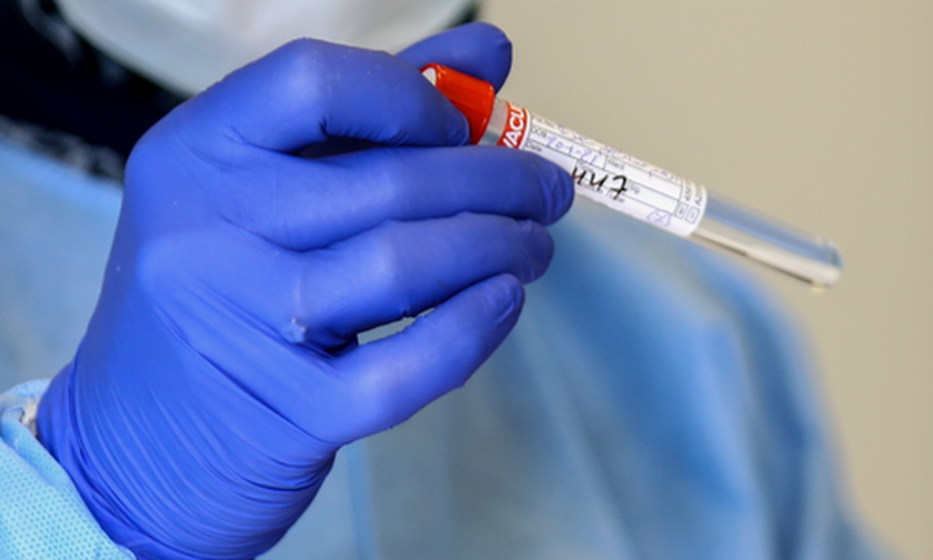 Κορονοϊός: 3.076 νέα κρούσματα, 337 διασωληνωμένοι, 22 νέοι θάνατοι