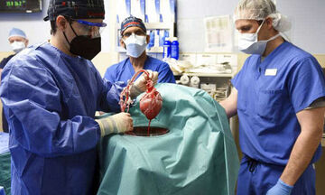 ΗΠΑ: Πέθανε ο πρώτος ασθενής που υποβλήθηκε σε μεταμόσχευση καρδιάς από γενετικά τροποποιημένο χοίρο