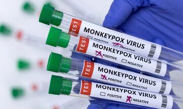 Ευλογιά των πιθήκων: Την Τρίτη 16 Αυγούστου φτάνουν στην Ελλάδα τα πρώτα εμβόλια (vid)