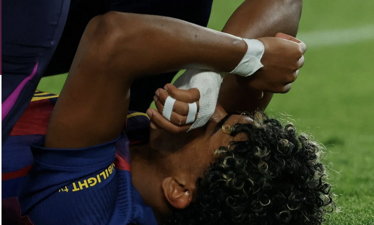 Μπαρτσελόνα: Χωρίς Γιαμάλ το υπόλοιπο της σεζόν...